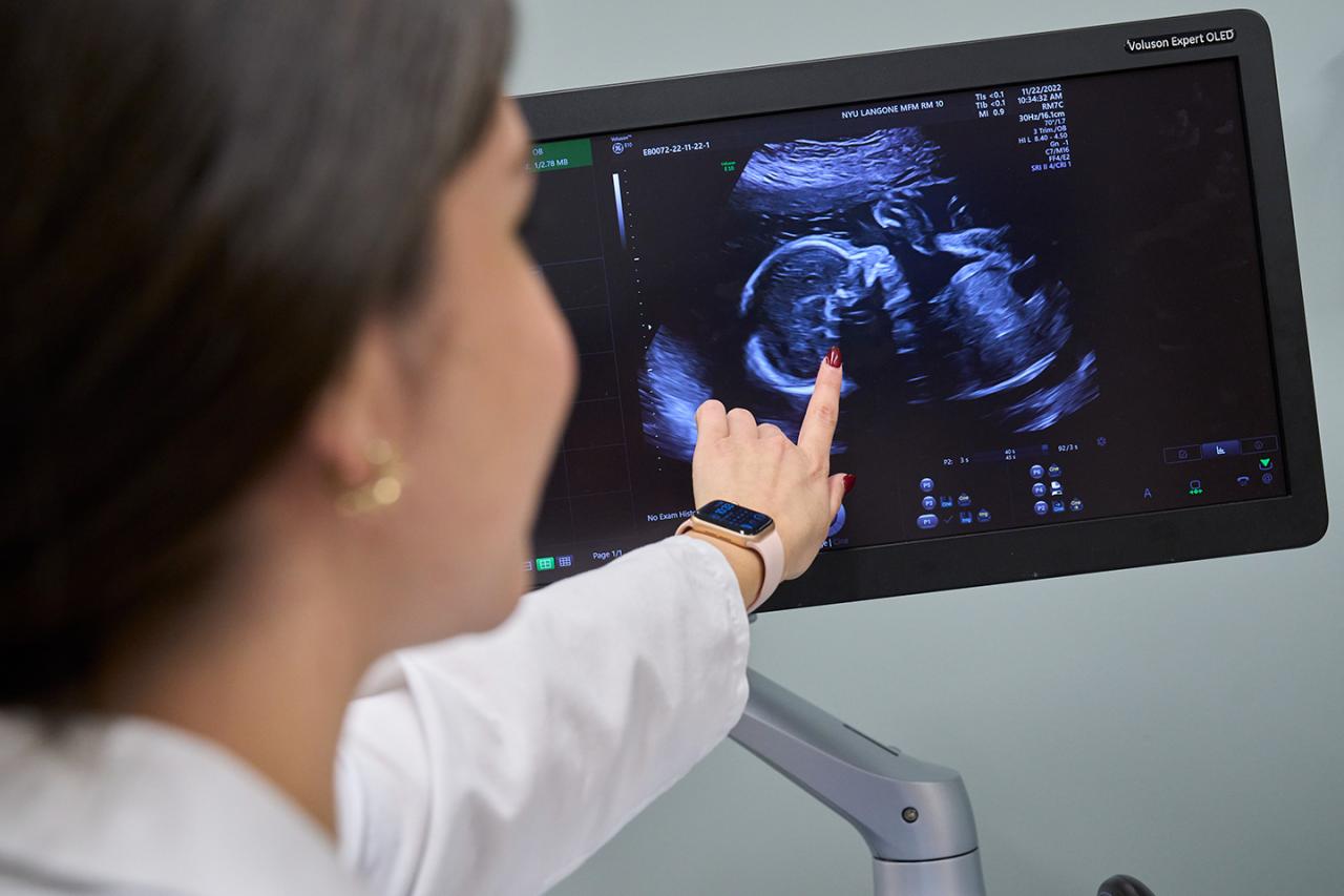 Ultrasound Technician Views Fetal Ultrasound