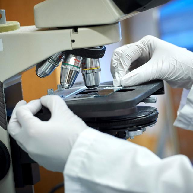 Kaposi NYU Langone Health