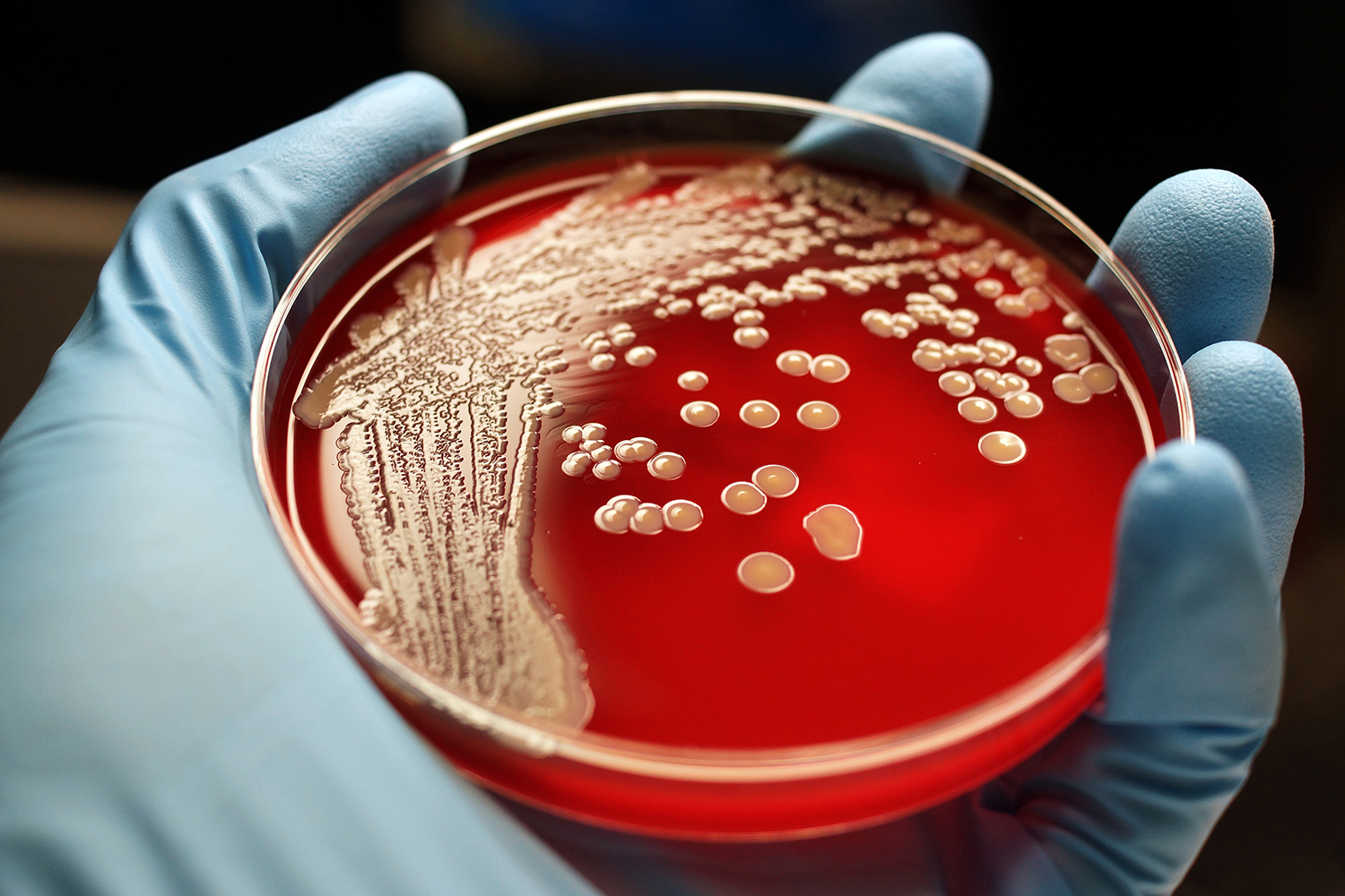 Strep Bacteria Compete For Ownership Of Human Tissue NYU Langone News