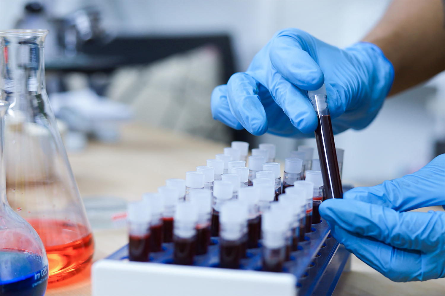 Gene-based Blood Test For Melanoma Spread Evaluates Treatment Progress 