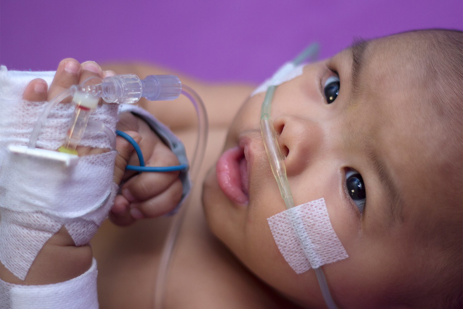 COVID-19–Associated Hospitalizations Among U.S. Infants Aged 6