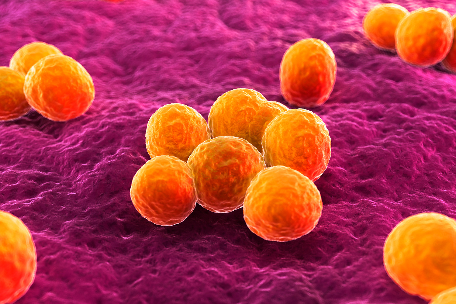 Prevention and Control of a Staphylococcus aureus Infection