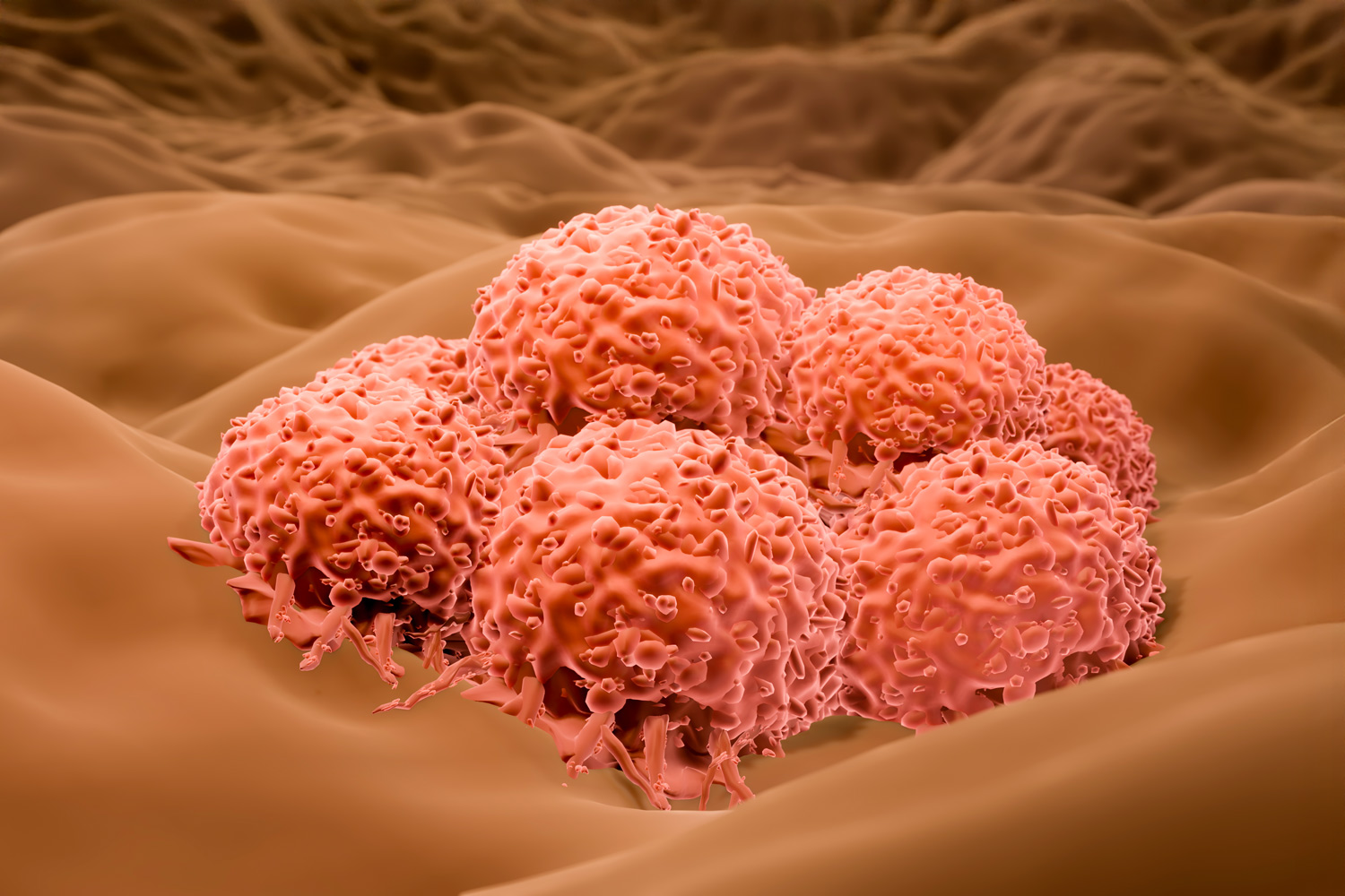 Molecule Found to Drive Skin Cancer Growth & Evade Immune Detection