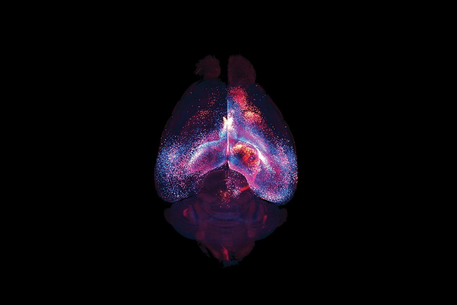 Brain Support Cells Form Previously Unknown Network