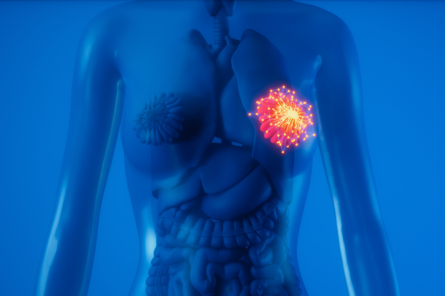 AI-Assisted Imaging Tool for Breast Cancer Could Tailor Screening for Women According to Individual Risk