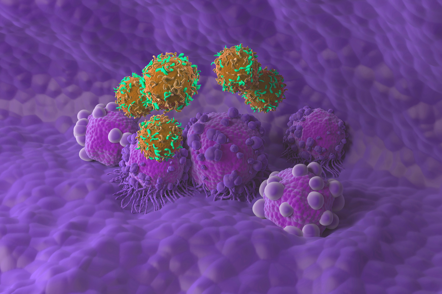 Continuously Evolving Cells Help Pancreatic Cancer Evade Treatment and Spread