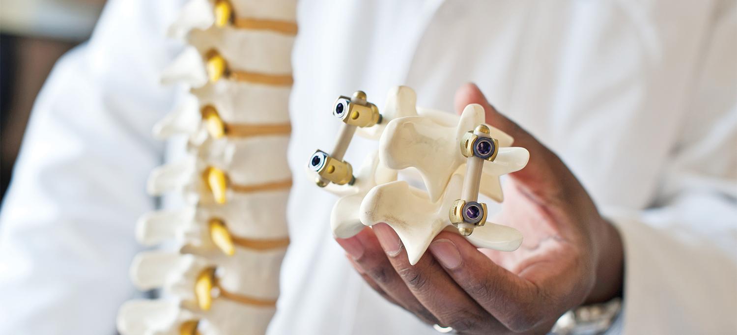 Doctor Holding Model of Spine