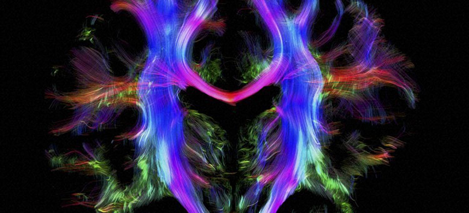 Pathways of Nerve Fibers in Young Adult Brain