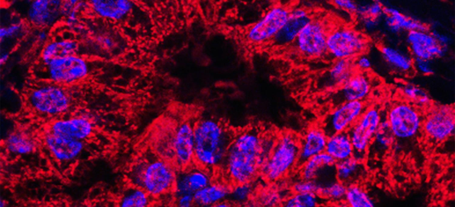 Mitochondrial Stained Pancreatic Cancer Cells