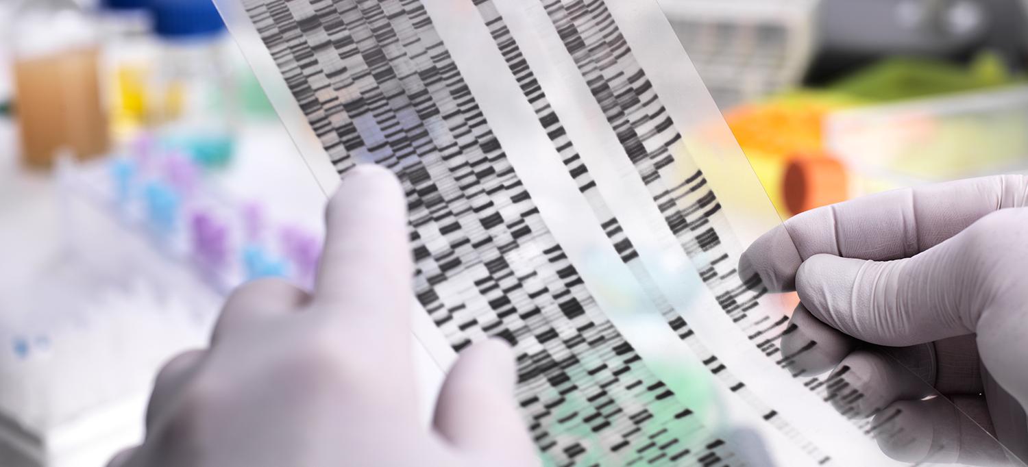 Scientist Holding DNA Gel