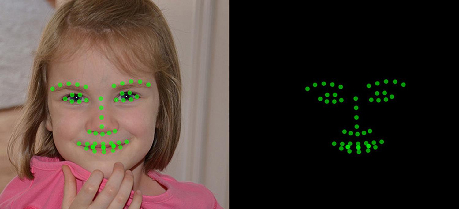 Child’s Face Is Screened for Autism