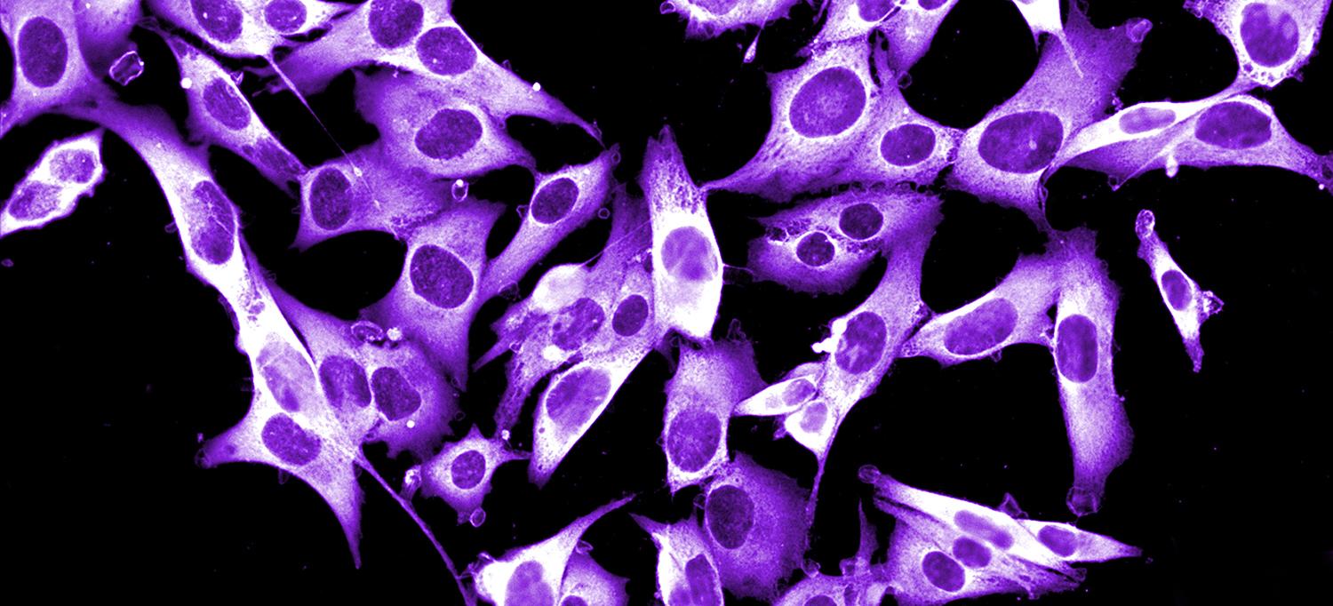 Melanoma Cells
