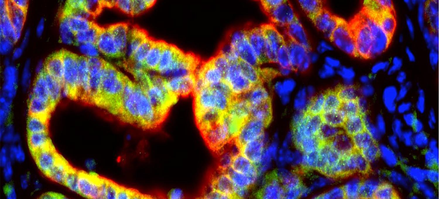 Mouse Pancreatic Tumor Cells