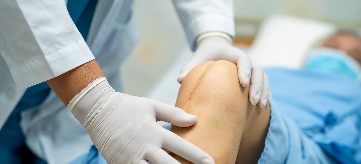 Doctor Examines Knee Healing from Surgery