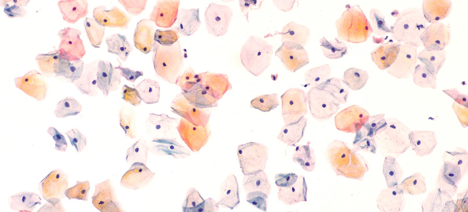 Cells in a Normal Pap Test