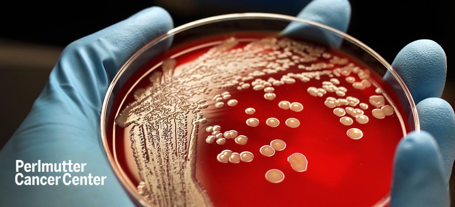 Bacterial Growth on a Petri Dish