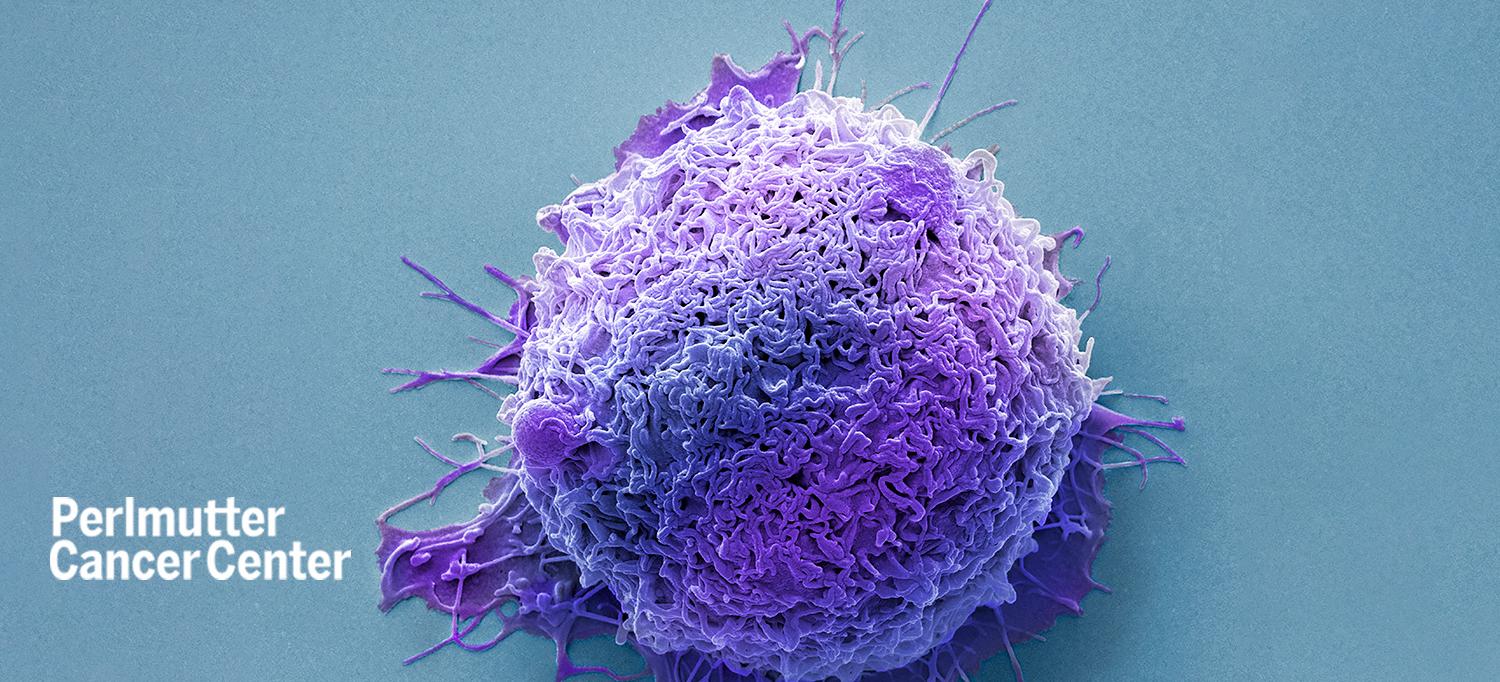 Colon Cancer Cell