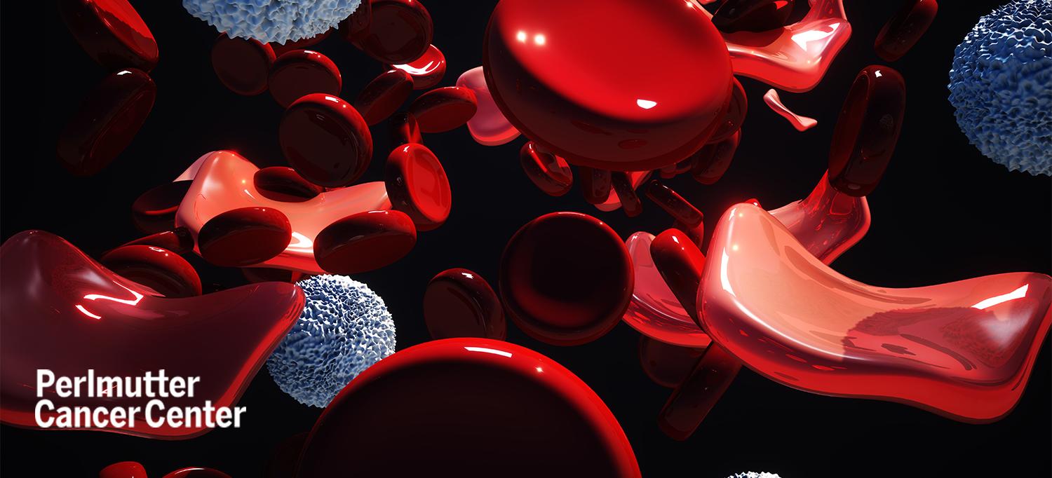 Illustration of Malformed Red Blood Cells in Thalassemia