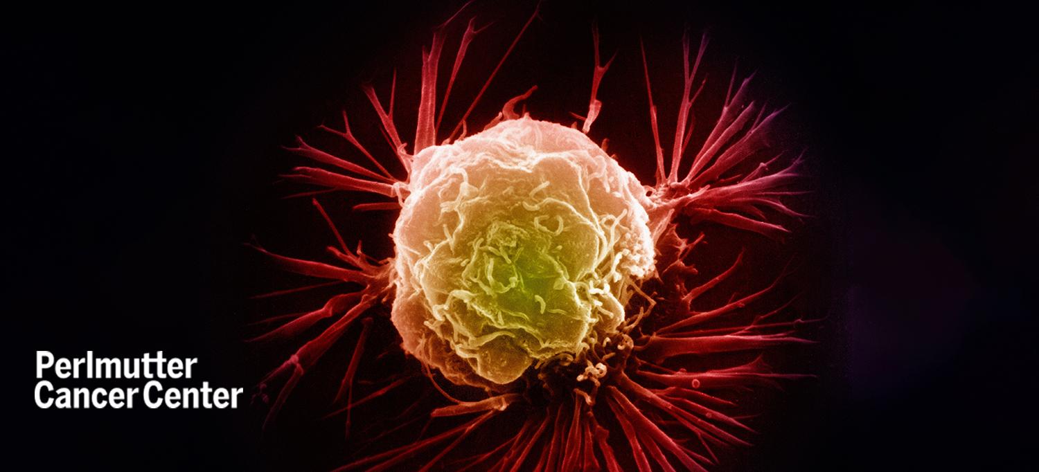 Breast Cancer Cell Observed Under Scanning Electron Microscope