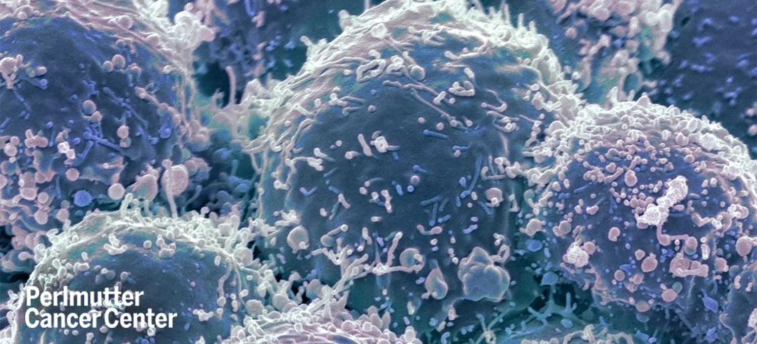 Close-Up View of Lung Cancer Cells