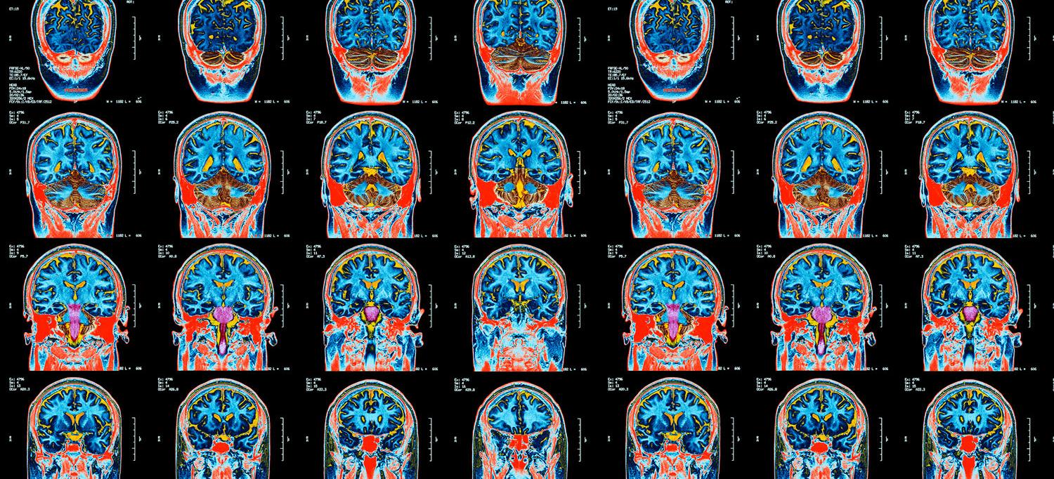 https://nyulangone.org/news/sites/default/files/styles/hero/public/2023-04/nyulh-news-spring-2023-brain-scans_0.jpg?h=ec98a0f6&itok=V-wFfzeZ&utm_source=chatgpt.com