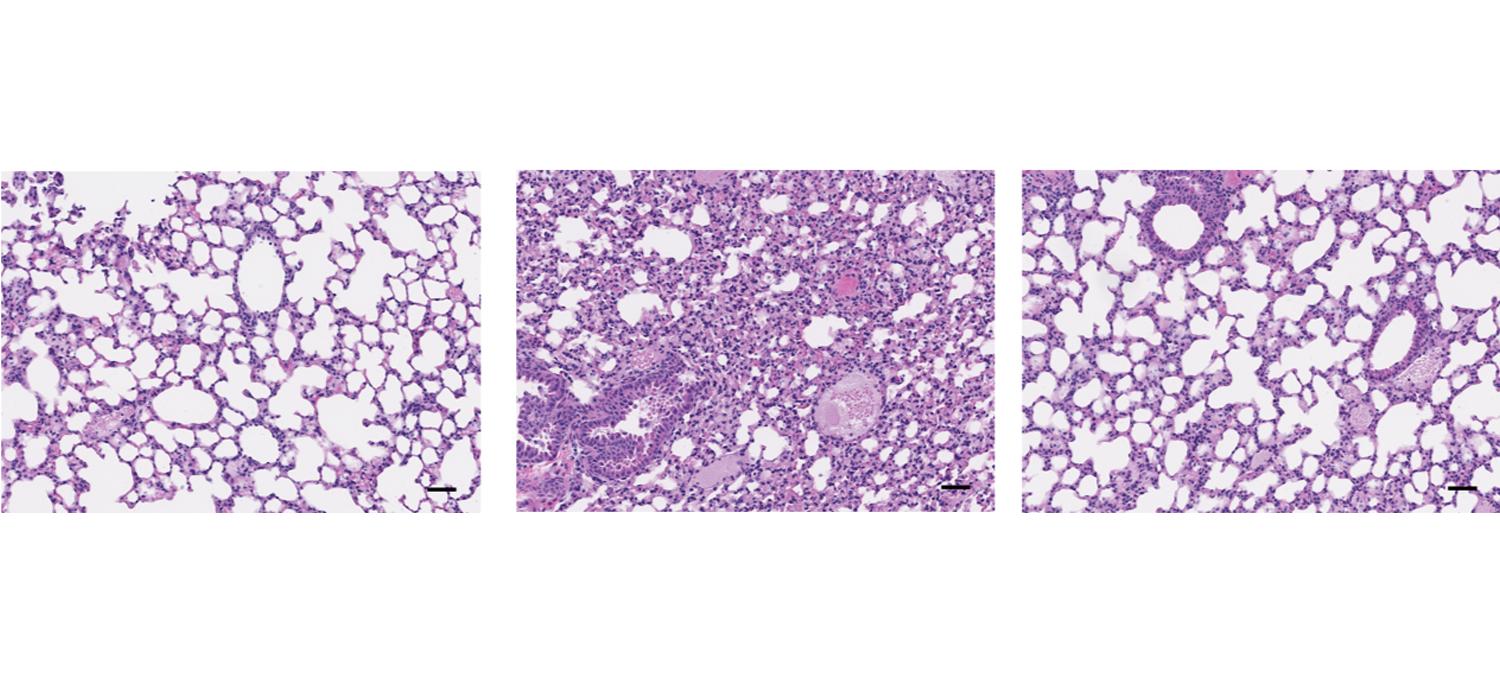 Three Light Microscopy Images of Mouse Lung Tissue Stained to Highlight Key Features