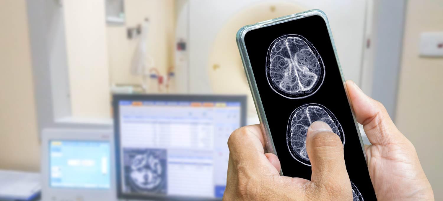 Hands holding smartphone showing MRI brain scans, with computer and electromagnetic control room in background