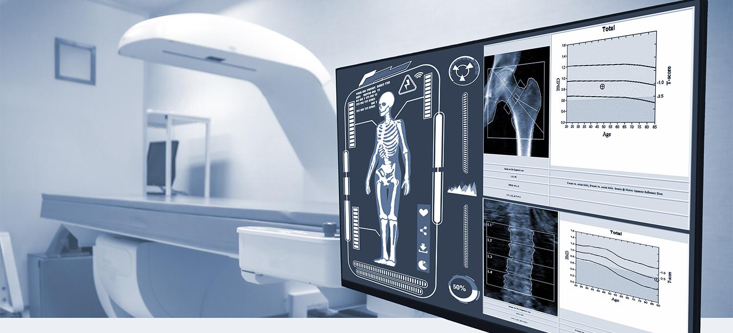 Full-body bone density scan results shown on screen next to dual x-ray absorptiometry scanner