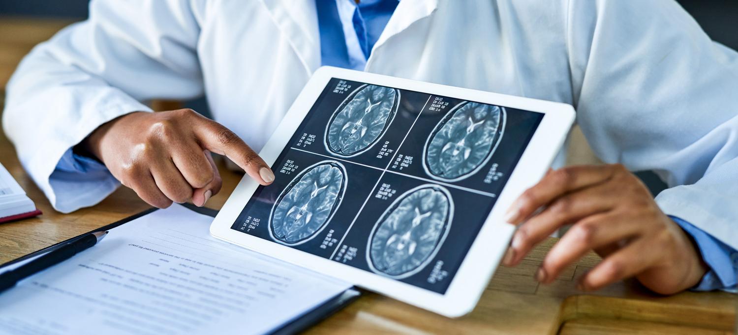 Healthcare professional holding up tablet showing brain scan results