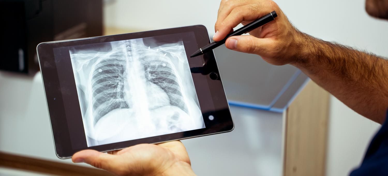 Person holding a tablet on which a chest X-ray is displaying.