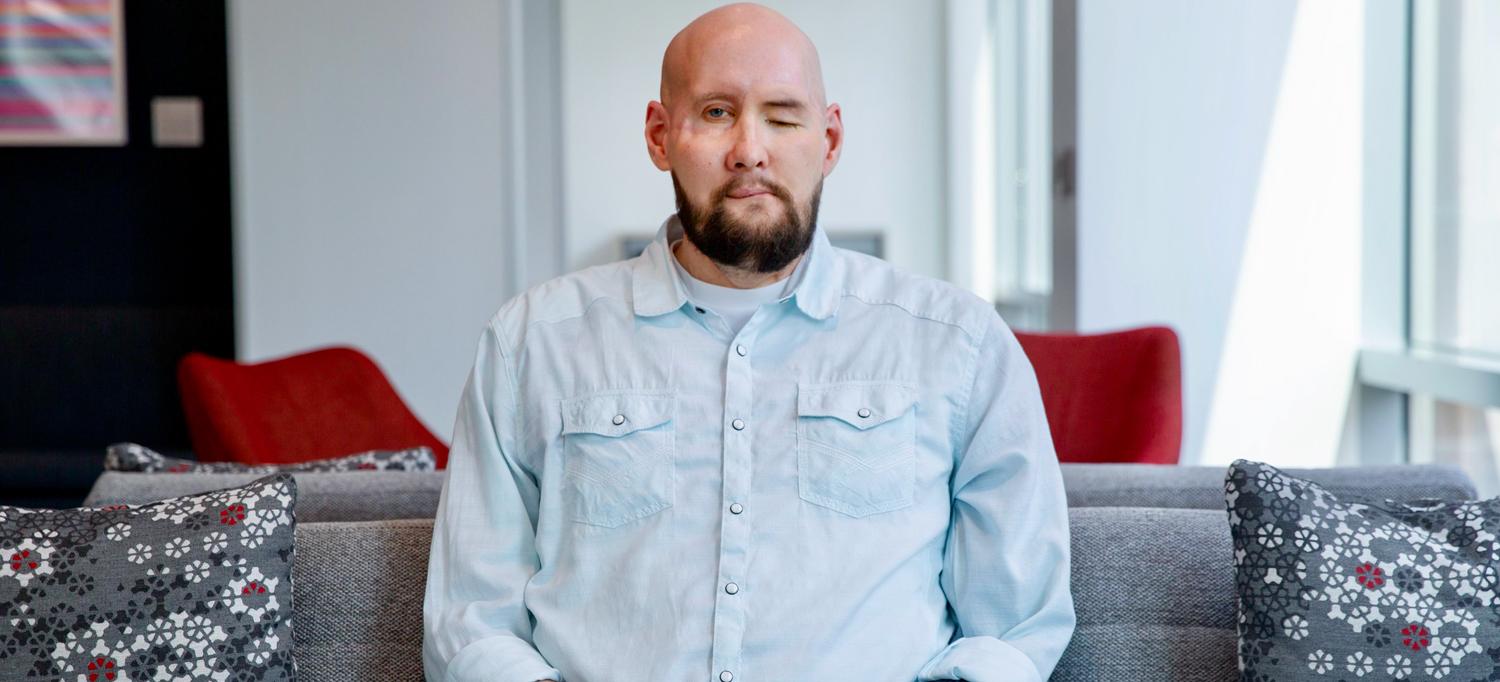 James sitting on a couch, with one eye closed and a prosthetic arm.