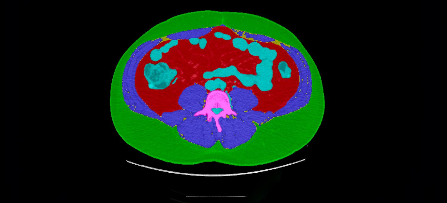 A CT scan image