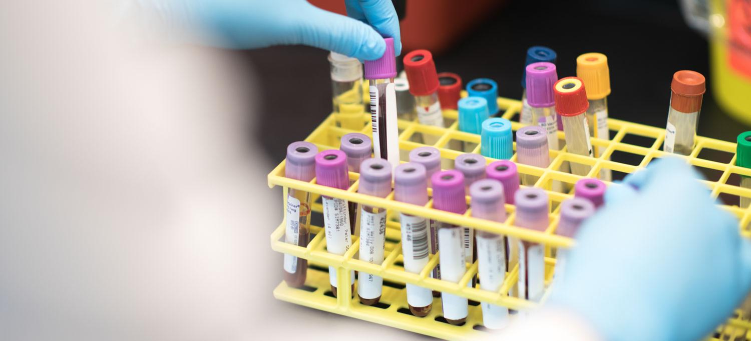 Blood vials being placed in a rack