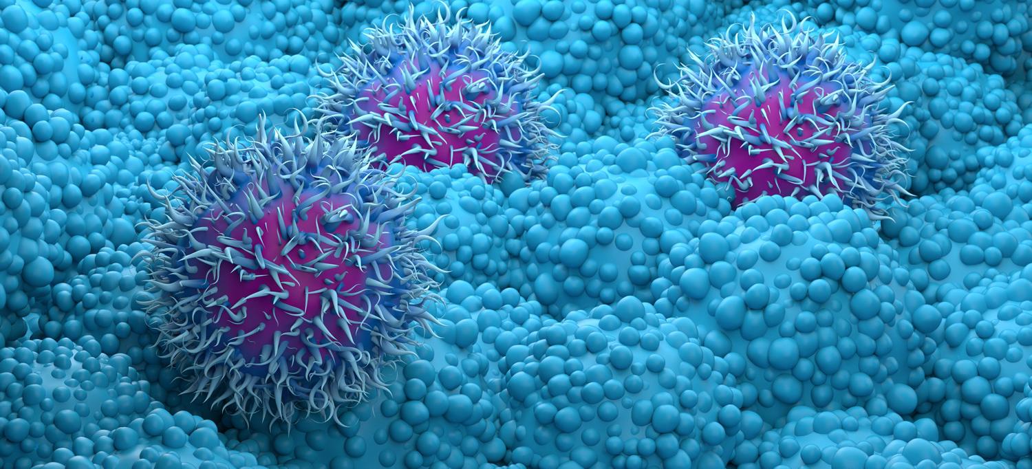 Illustration of pancreatic cancer cells