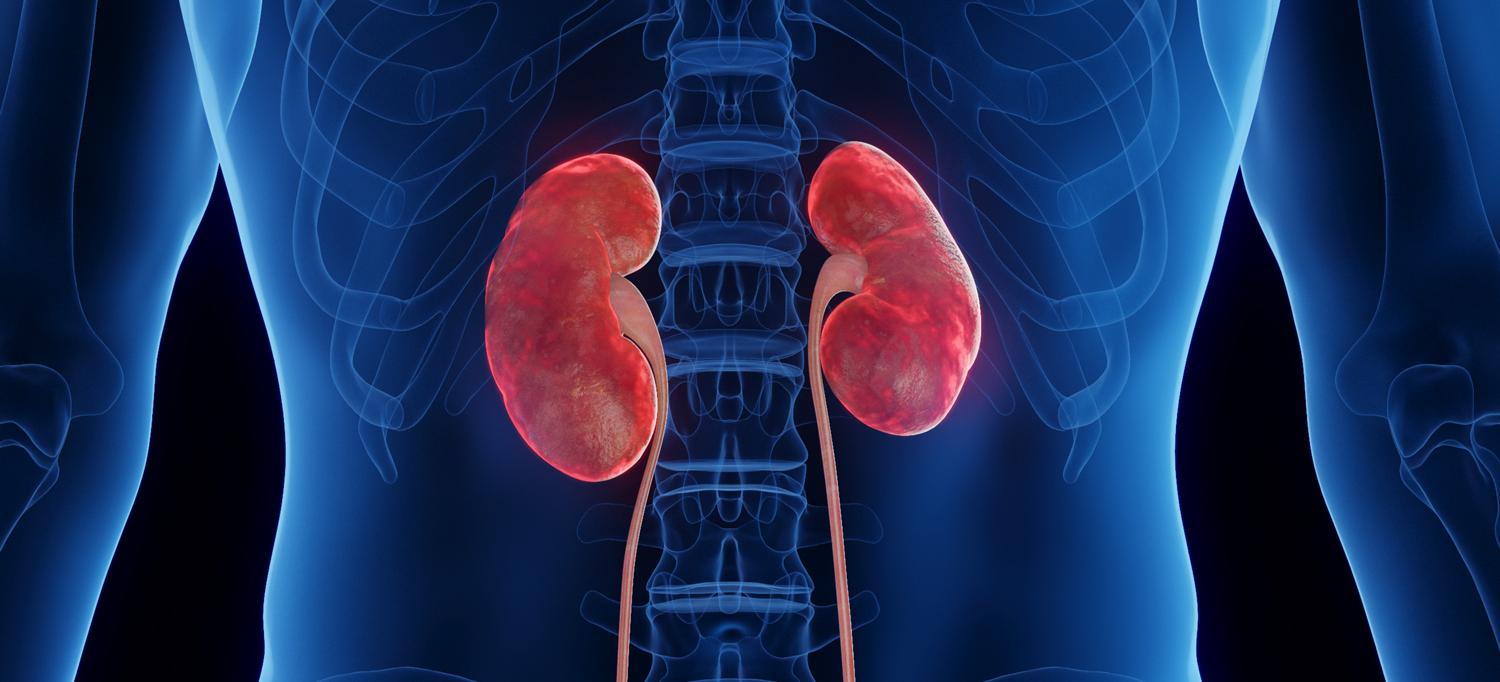 Illustration of inflamed kidneys