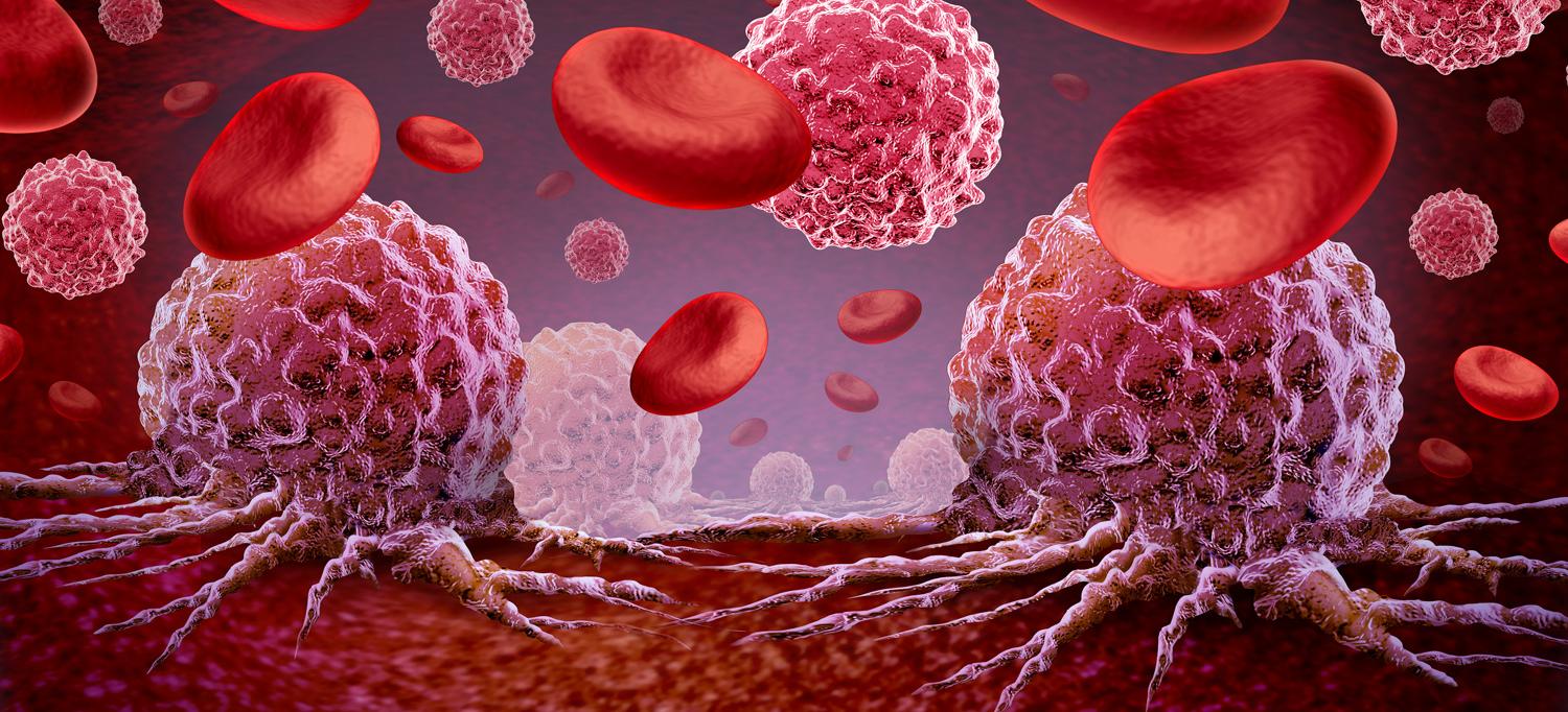 Illustration of leukemia cells