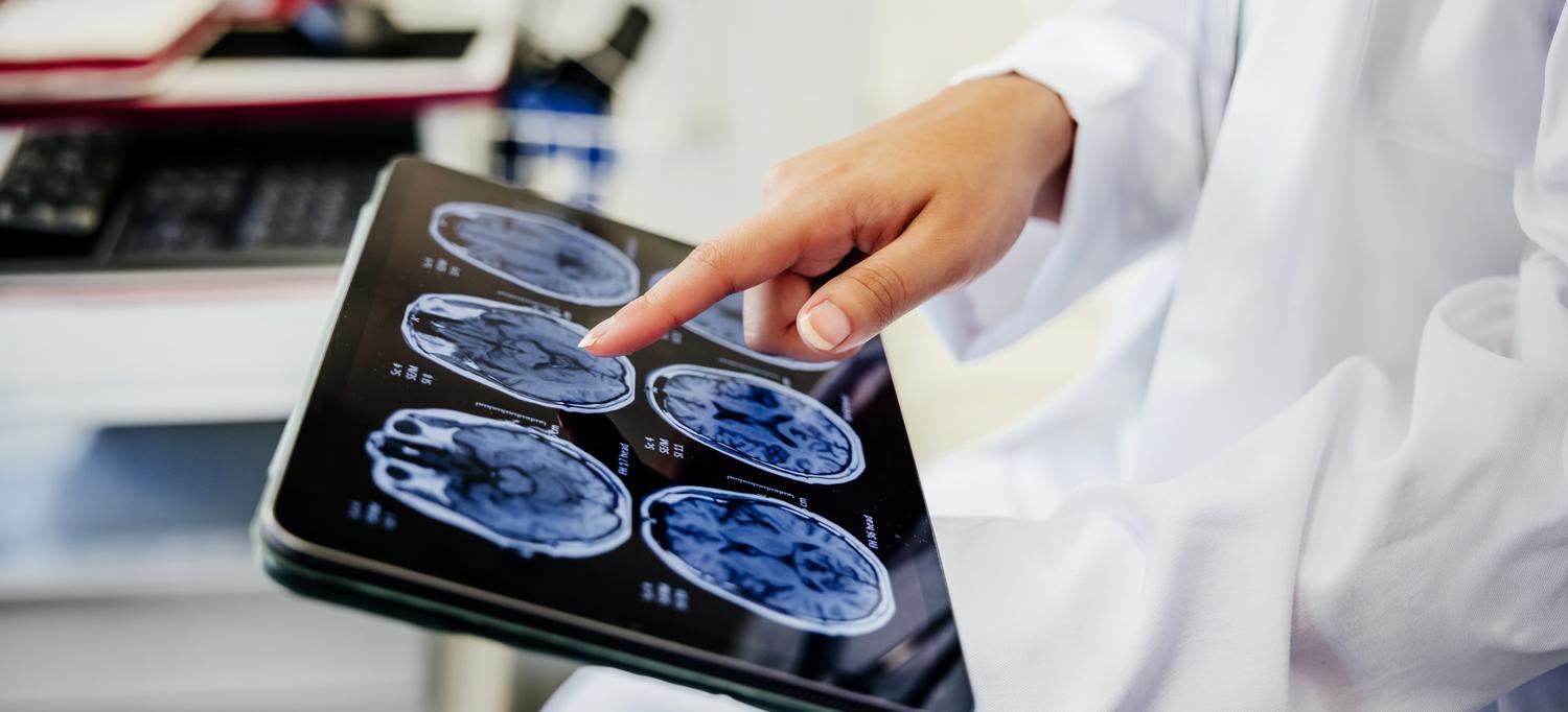 Brain X-ray scans shown on a screen.