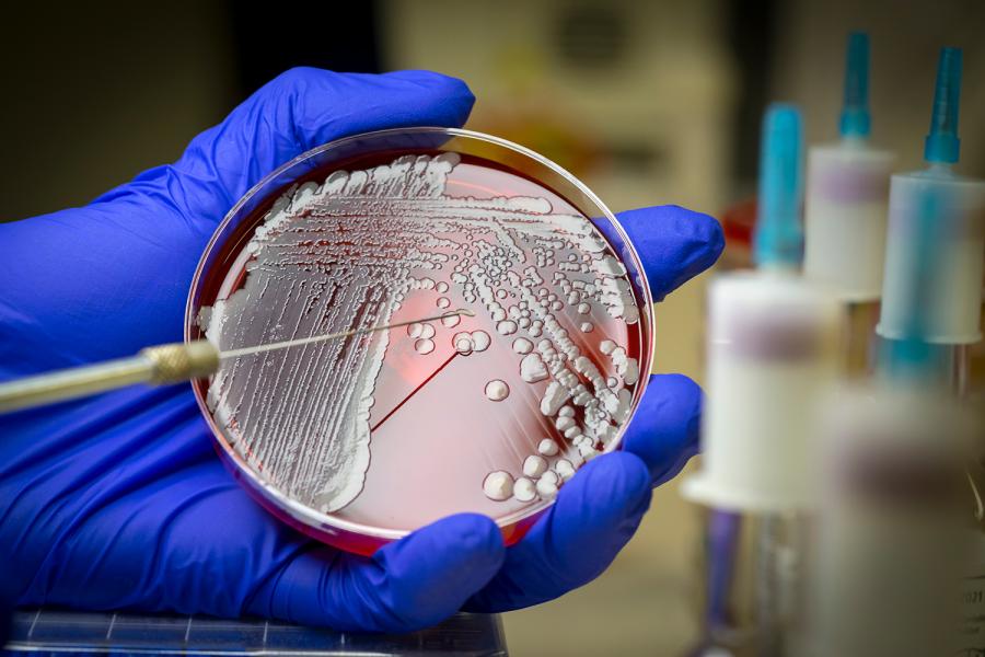 Antimicrobial-Resistant Pathogens Program | NYU Langone Health