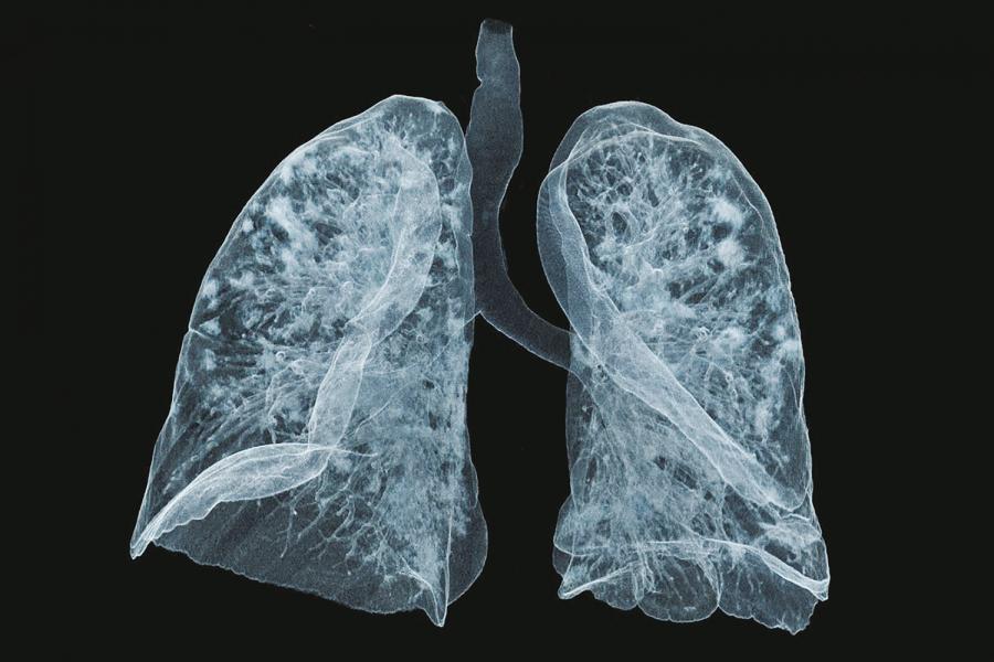 Department Of Radiology Nyu Langone Health Department Of Radiology Nyu Langone Health
