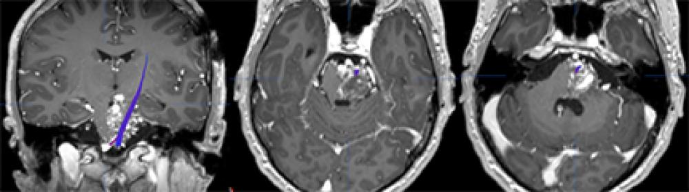 Brain MRIs