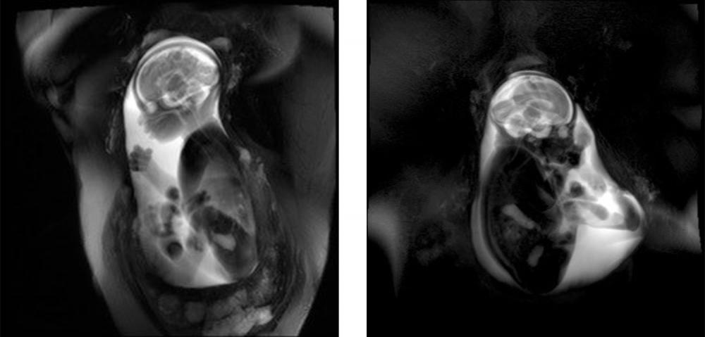 MRI Scans of Human Fetus