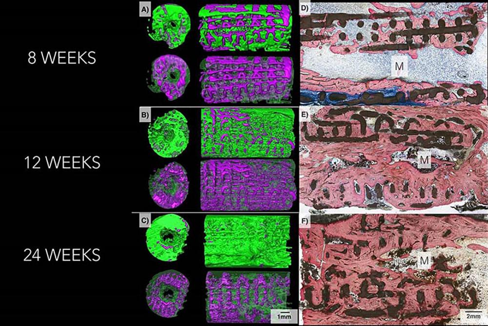 Three-dimensional Imaging of Bone Over 24 Weeks