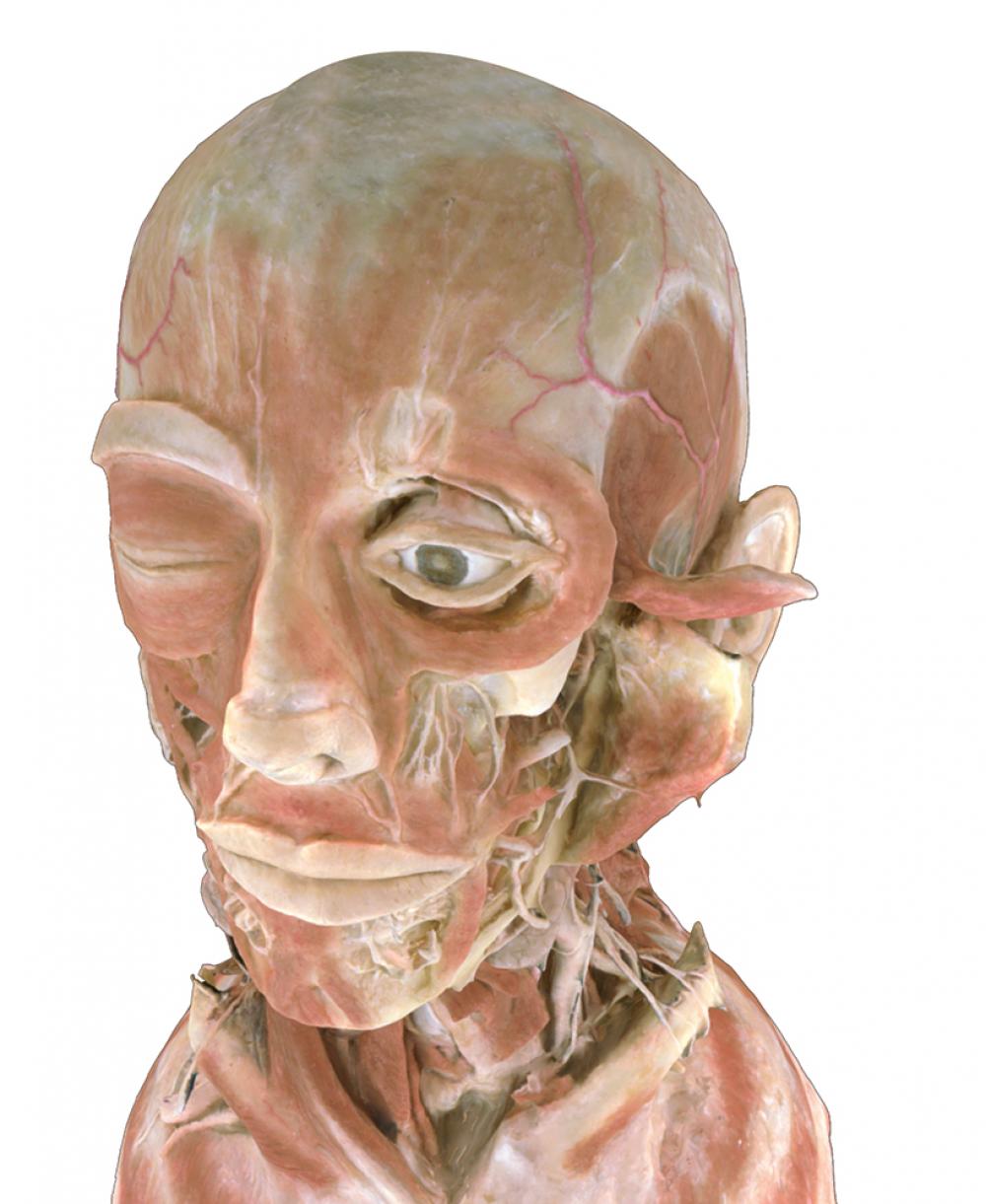 Head of Plastinated Cadaver