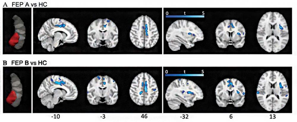 Brain Functional MRI Results