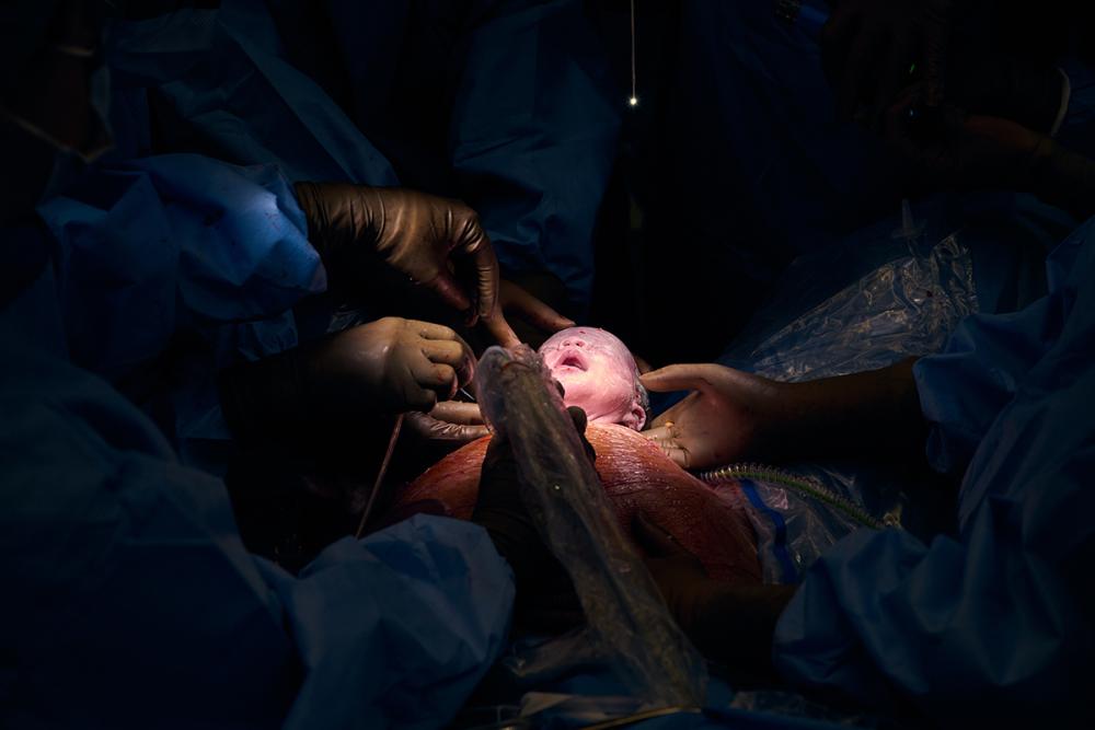 Aydin Martin’s Head Emerges via Cesarean Delivery and Several Gloved Hands Hold His Head and Perform Procedures