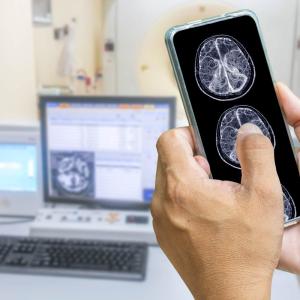 Hands holding smart phone showing brain scan images, with computer in background