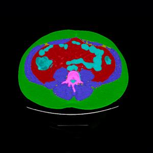 A CT scan image