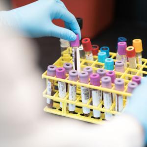 Blood vials being placed in a rack