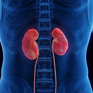 Inflamed Kidney Lupus, stock illustration