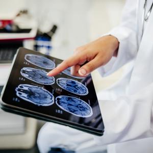 Brain X-ray scans shown on a screen.